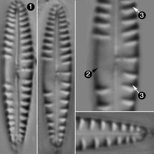 Gomphonema Variostriatum Guide