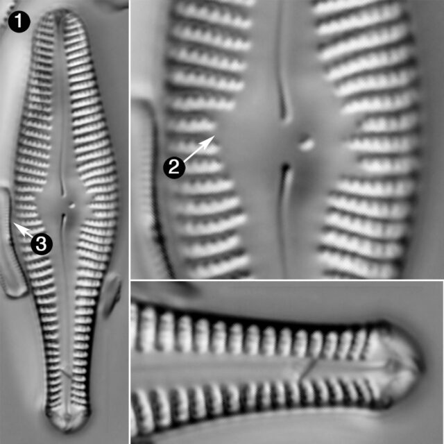 Gomphonema Ventricosum Guide