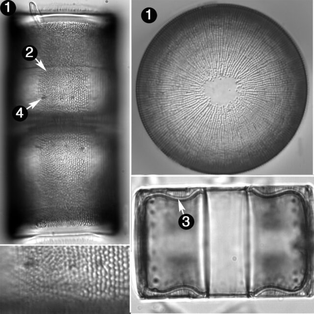 Melosira Undulata Guide