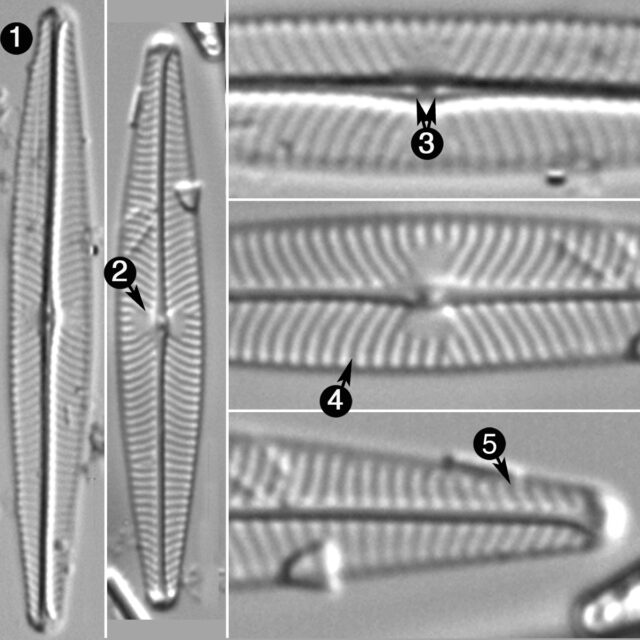 Navicula Leptostriata Guide