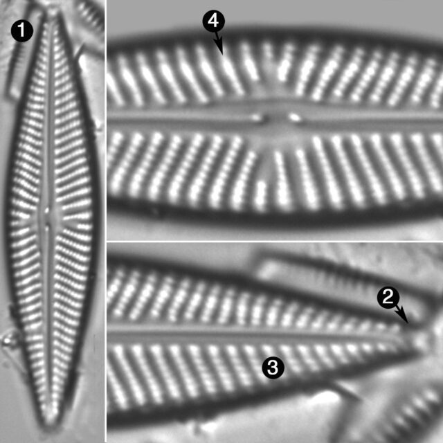 Navicula Pseudolanceolata Guide