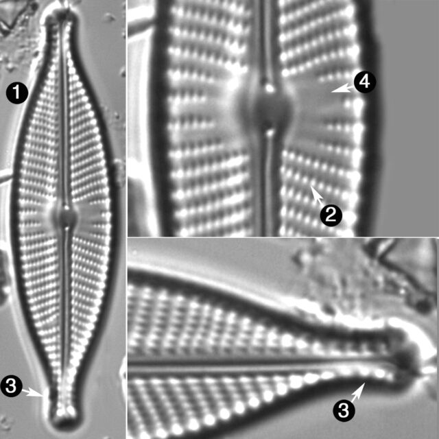 Navicula Rhynchotella Guide