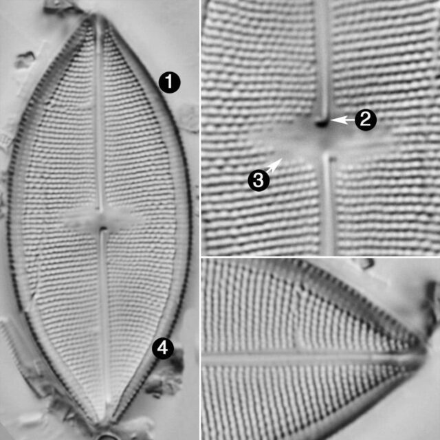 Neidium Pseudodensestriatum2 Guide