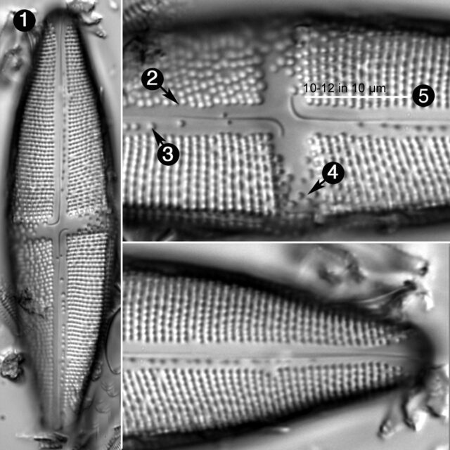 Neidium Undulatum Guide