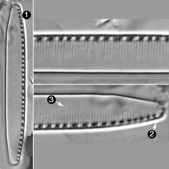 Nitzschia Communis Guide