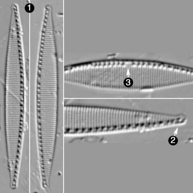 Nitzschia Fonticola Guide