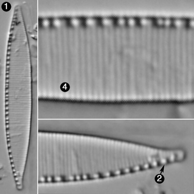 Nitzschia Minuta Guide