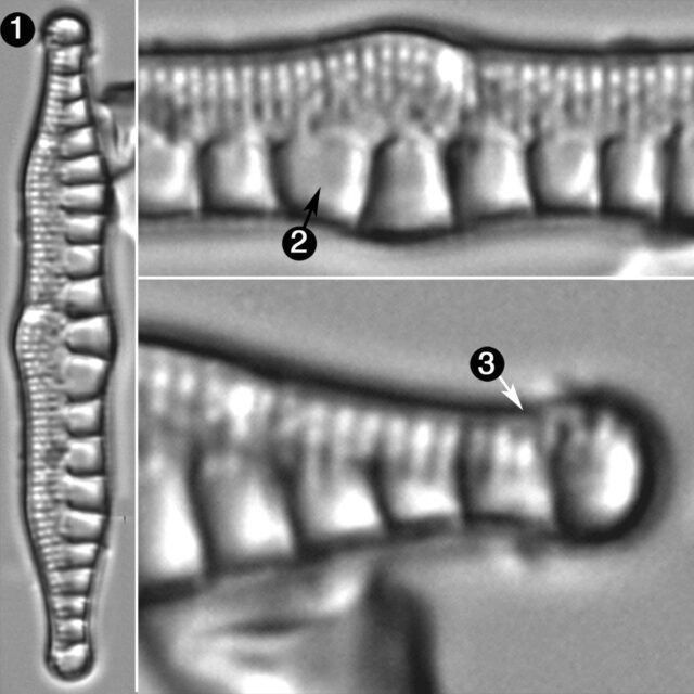 Nitzschia Sinuata Guide