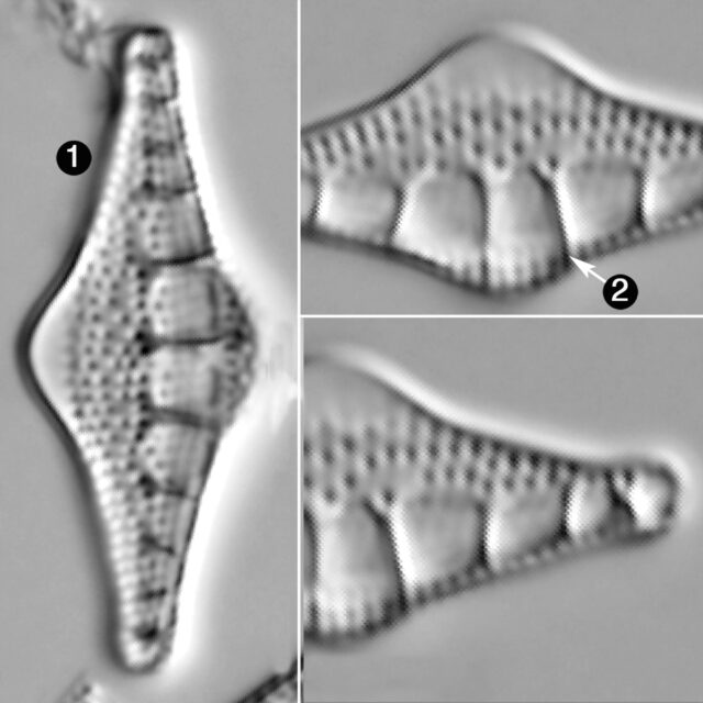 Nitzschia Sinuata V Tabellaria Guide