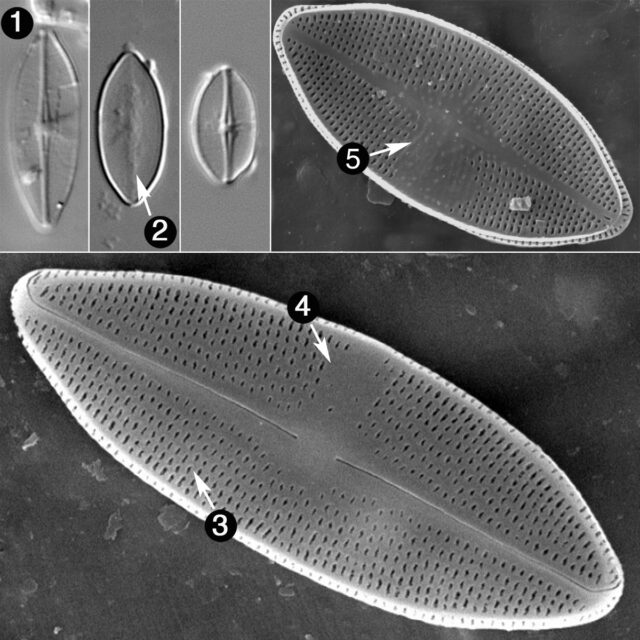 Nupela Scissura Guide