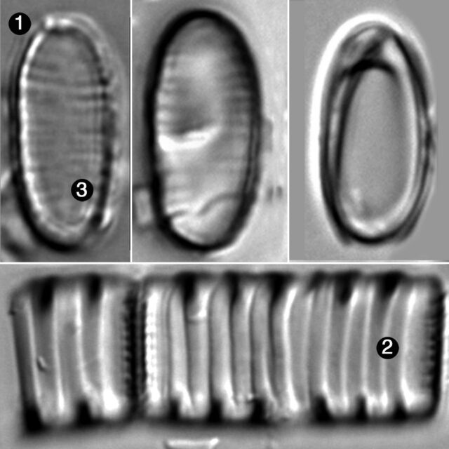 Oxyneis Binalis Elliptica Guide