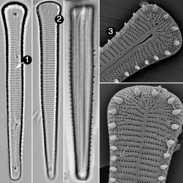 Peronia Fibula Guide