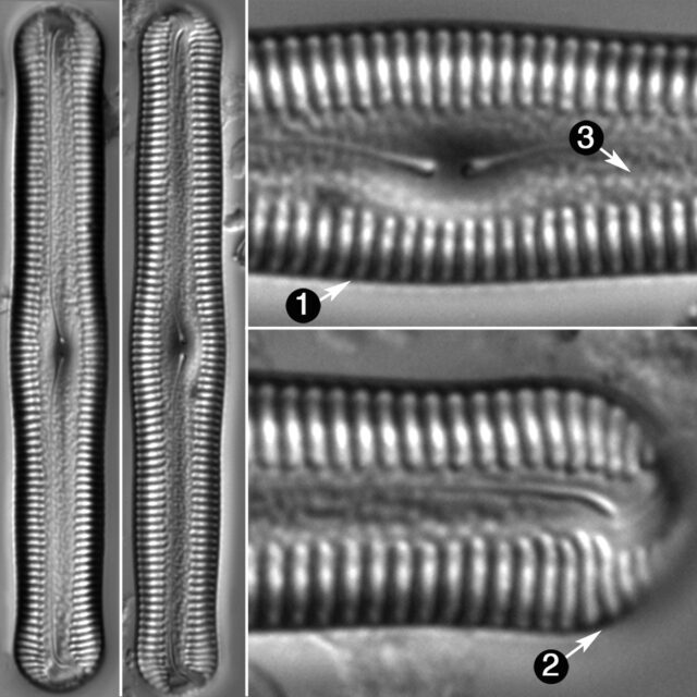 Pinnularia Acrosphaeria Guide