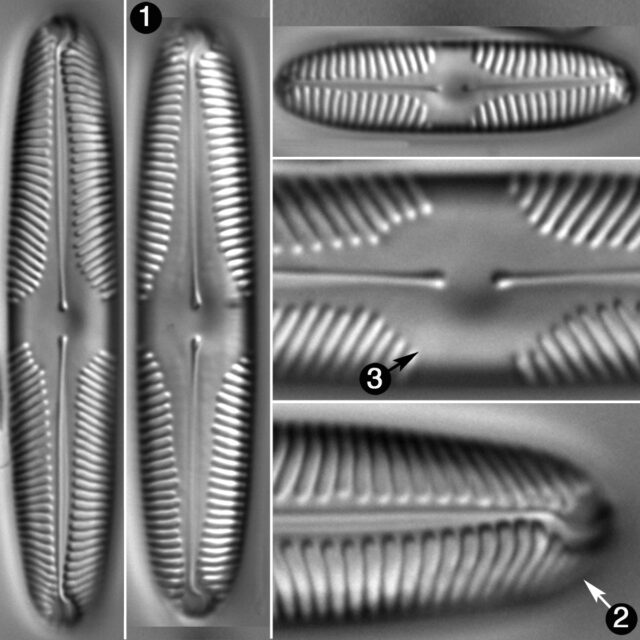 Pinnularia Brebissonii Guide