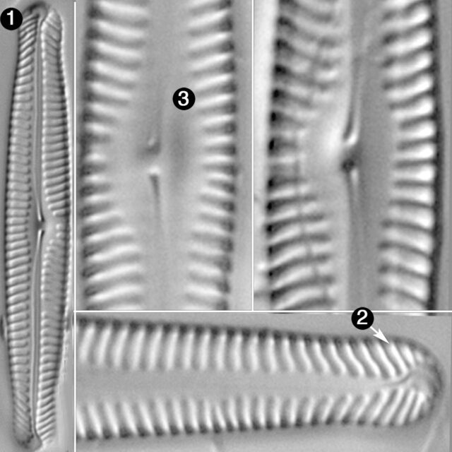 Pinnularia gibbiformis guide