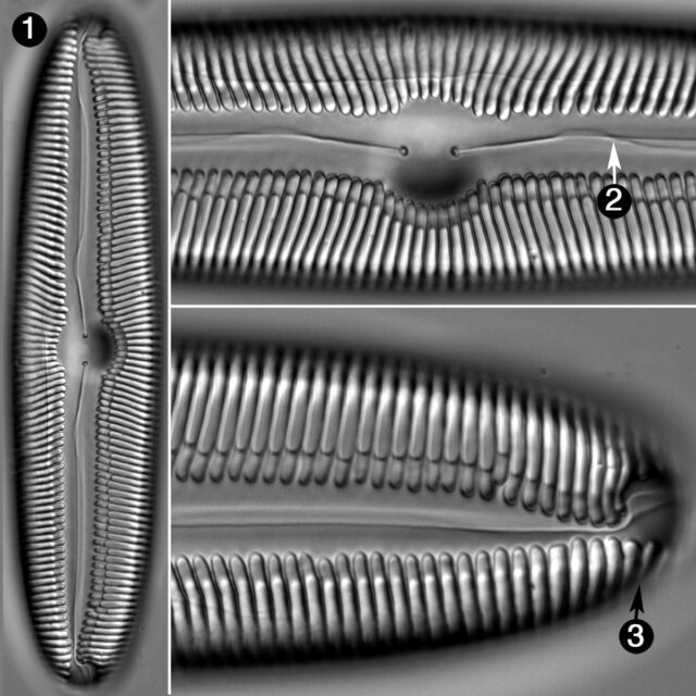 Pinnularia Gigas Guide