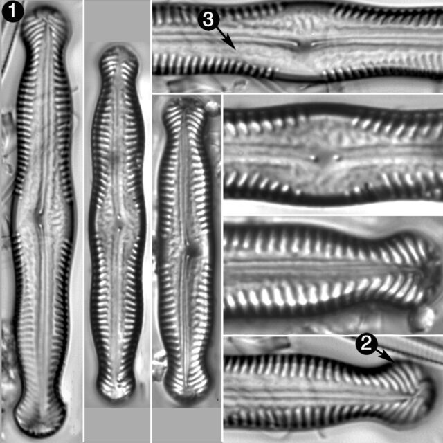 Pinnularia Nodosa Percapitata Guide