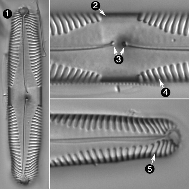 Pinnularia Parvulissima Guide