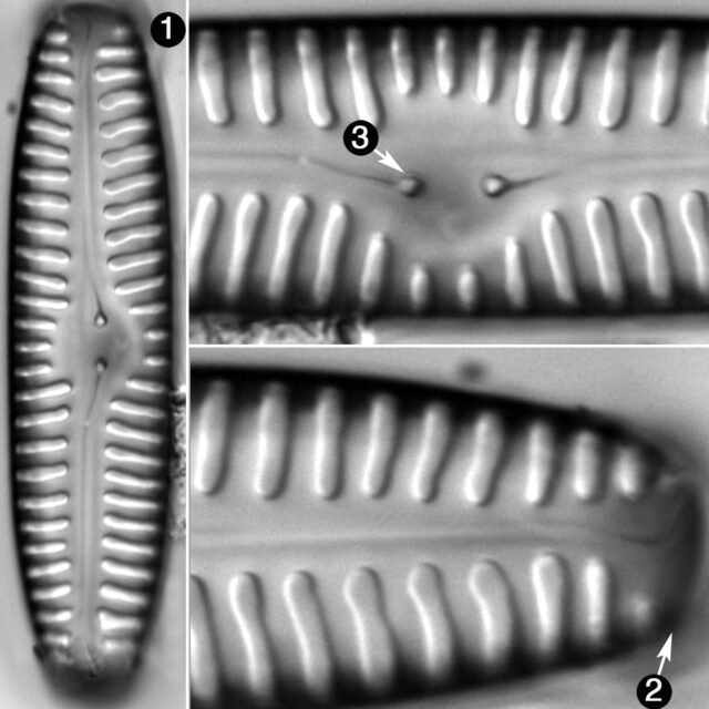 Pinnularia Rabenhorstii Guide