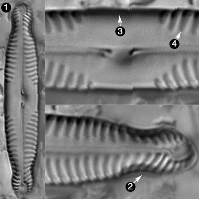 Pinnularia Saprophila Guide