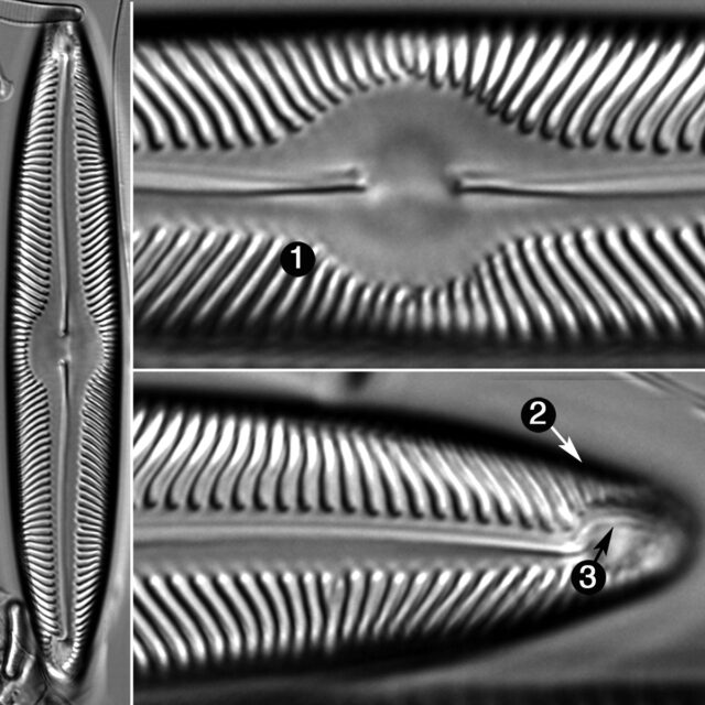 Pinnularia Turfosiphila Guide