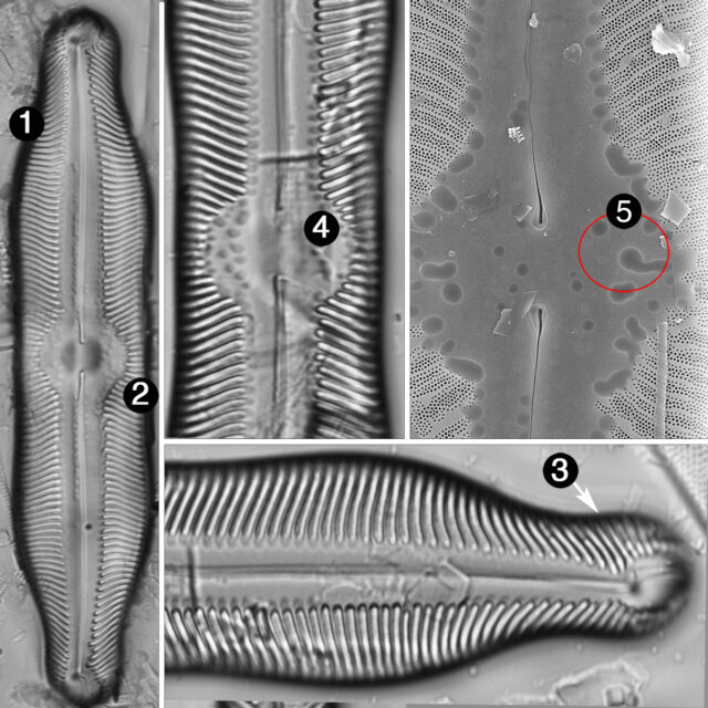 Pinnularia undula major guide