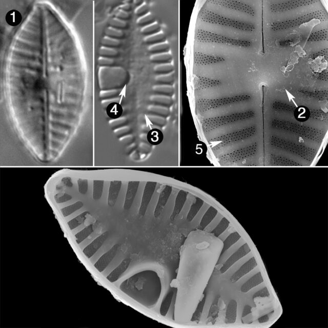 Planothidium Abbreviatum Guide