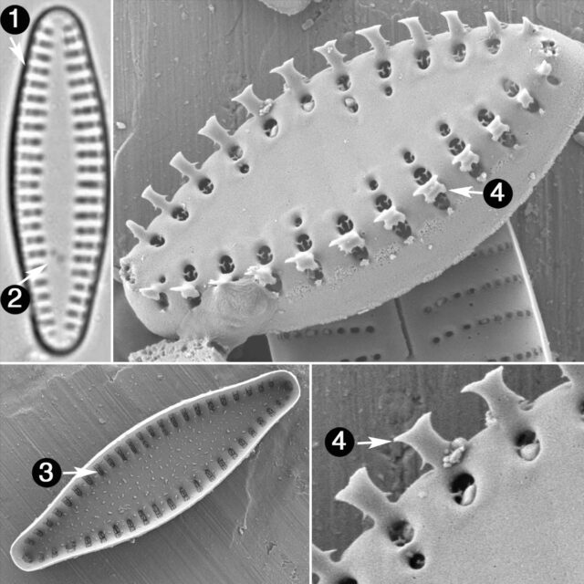 Pseudostaurosira Brevistriata Guide