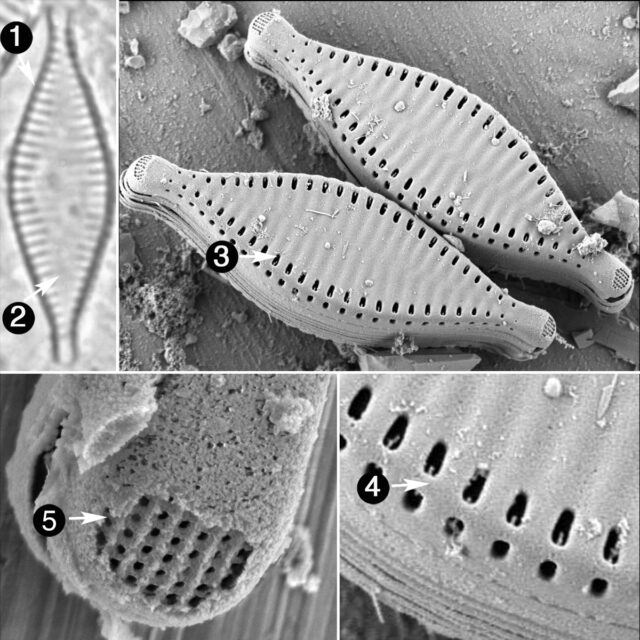 Pseudostaurosira Parasitica Guide