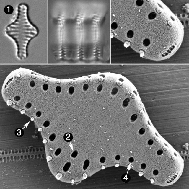 Pseudostaurosira Pseudoconstruens Guide