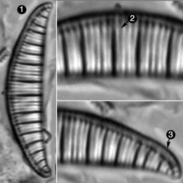 Rhopalodia Gibberula Guide