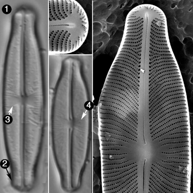 Sellaphora Stauroneioides Guide