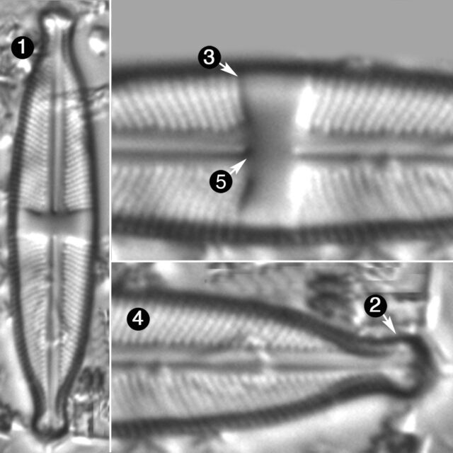 Stauroneis Pseudoagrestis Guide