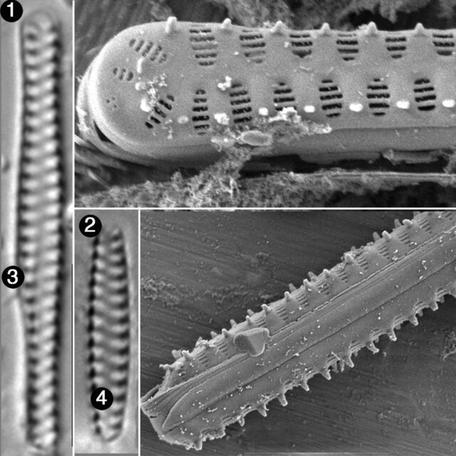 Staurosirella Berolinensis2 Guide