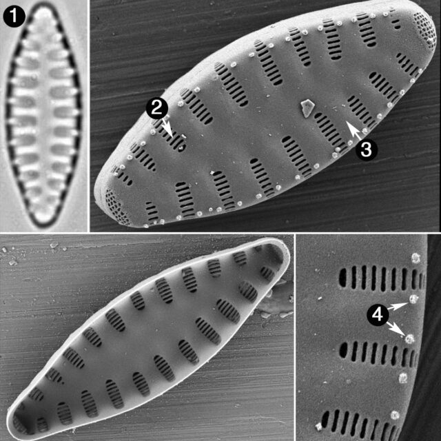 Staurosirella Leptostauron Dubia Guide