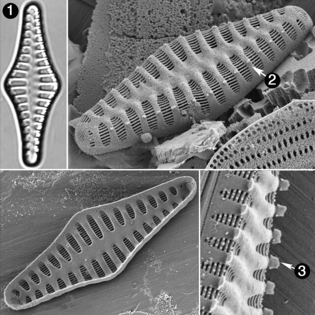 Staurosirella Rhomboides Guide