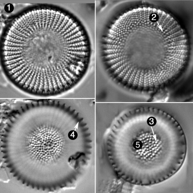 Stephanodiscus Alpinus Guide