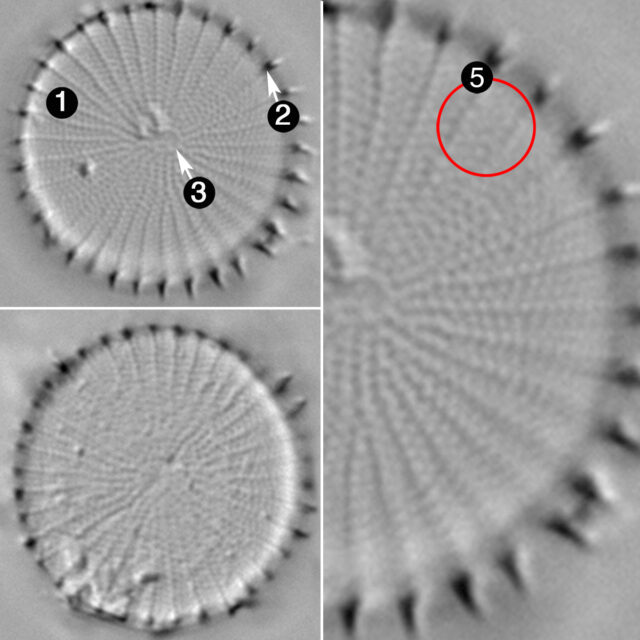 Stephanodiscus Hantzschii Fo Tenuis Guide