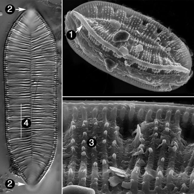 Surirella Amphioxys Guide