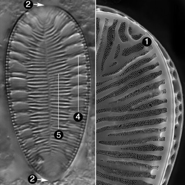 Surirella Brebissonii Guide