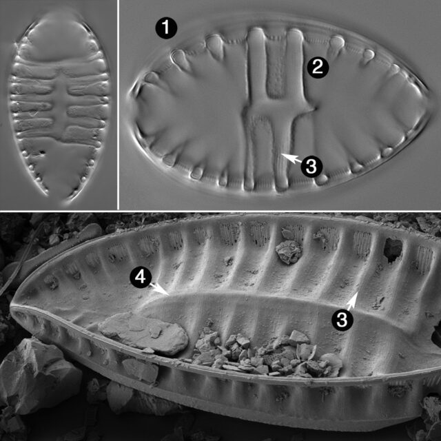 Surirella Cruciata Guide