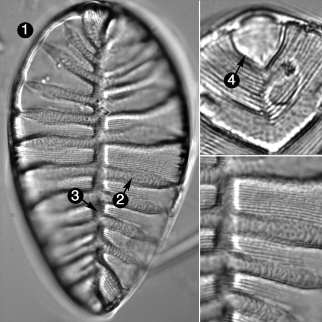 Surirella Striatula Guide