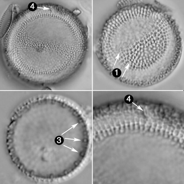 Thalassiosira Lacustris Guide