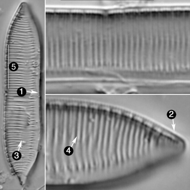 Tryblionella Calida Guide