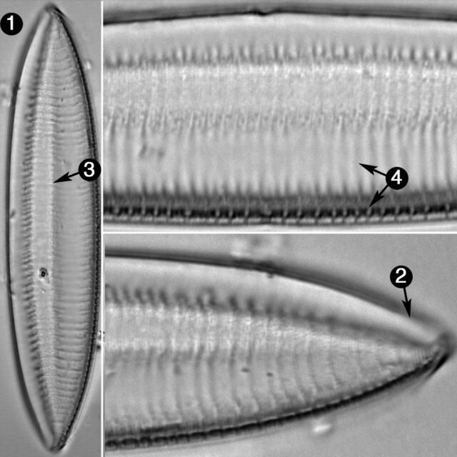 Tryblionella Gracilis Guide