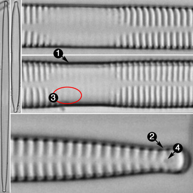 Ulnaria Contracta Guide