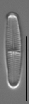 Achnanthidium minutissimum LM3