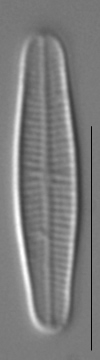 Achnanthidium minutissimum LM4