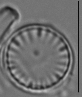 Cyclotella atomus LM2