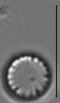 Cyclotella atomus LM3